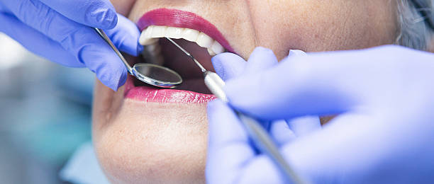Best Emergency Dental Care for Sports Injuries in Lacy Lakeview, TX